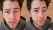 Nick Jonas - Foto: Reprodução / Instagram